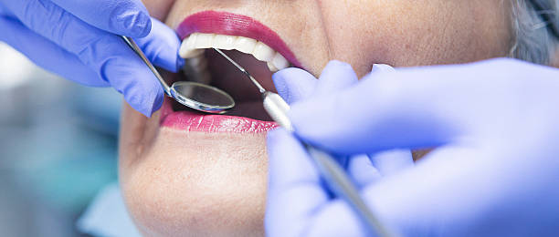 Best Emergency Dental Extractions in Westway, TX